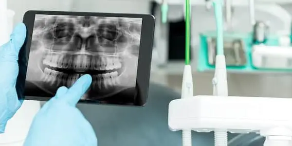 Technology and Advances in Dentistry