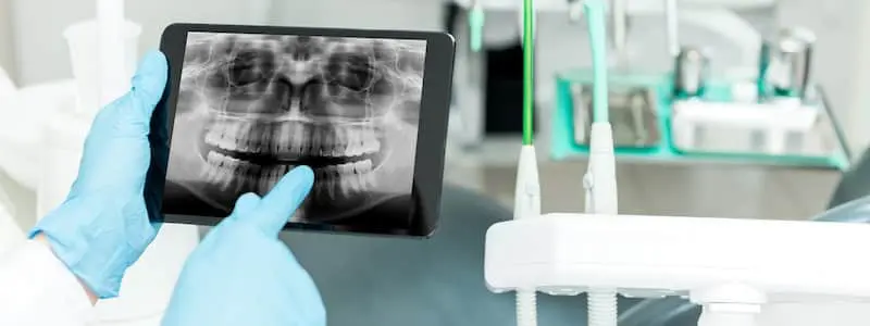 Technology and Advances in Dentistry
