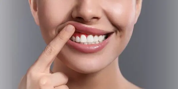 National Gum Care Month