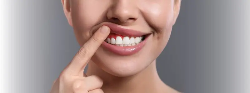 National Gum Care Month